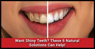 Six Natural Dental Solutions To Make Your Teeth Shine Like Never Before