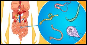 10 Signs You Might Have Tapeworms And Why They Are Harmful