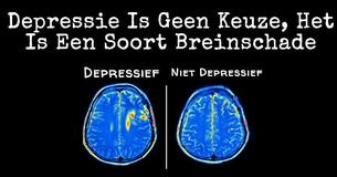 Nieuw Onderzoek Laat Zien Dat Depressie Zorgt Voor Breinschade En Niet Andersom 