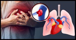 Call 911 If You See These 7 Symptoms Of A Blood Clot 