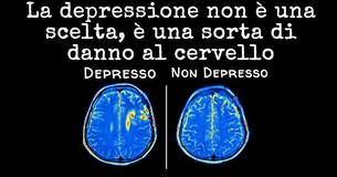 Nuove ricerche dimostrano che la depressione causa danni al cervello, e non il contrario 