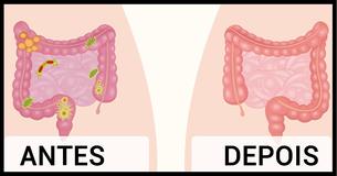 Sentindo-se Inchado? Estes 2 Ingredientes Vão Deixá-lo Mais lLve  