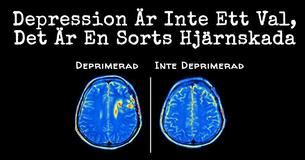 Ny Forskning Visar Att Depression Orsakar Hjärnskada, Inte Tvärtom  