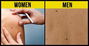 9 Myths About Moles And Skin Health You Should Avoid