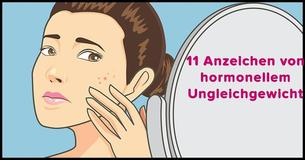 Diese 11 Symptome von hormonellem Ungleichgewicht sollte jede Frau kennen 