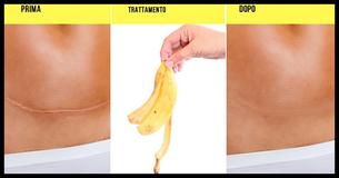 Bucce di banana: 10 modi per non sprecarle                                        
                                    