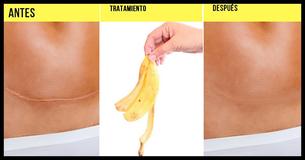 Cáscaras de banano: diez maneras de no desperdicicarlas                                       
                                    