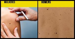 9 mitos sobre pintas e saúde de pele que você deve evitar                                        
                                    
