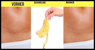 Bananenschalen: Mit diesen 10 Tricks verschwendest Du nichts                   