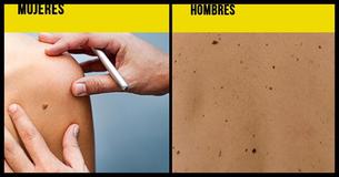 9 mitos sobre los lunares y la salud de la piel que debes evitar                                        
                                    