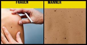 9 Mythen über Leberflecke und Muttermale, die Du nicht glauben solltest
