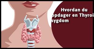 Alt du behøver at vide om at opdage, diagnosticering og behandling af skjoldbruskkirtler                                        
                                    