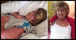 Mãe morre depois de ignorar a mordida de um inseto comum, a sua filha fala sobre o seu erro