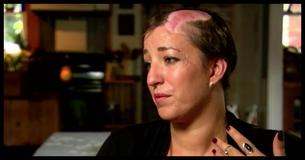 In Een Fractie Van Seconde Gescalpeerde Moeder Stuurt Een Urgent Bericht Aan Alle Vrouwen