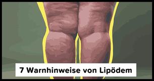 Lipödem wird oft mit Fettleibigkeit verwechselt: 7 Symptome auf die Du achten solltest