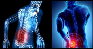 8 Sciatica Stretches That Help Relieve And Prevent Hip And Lower Back Pain