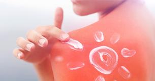 Try 8 Natural Ways To Heal Sunburns And The Pain Will Go Away Before You Know It