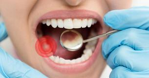 8 Remedies to Cure A Toothache (Without the Dentist)