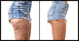 8 einfache und effektive Übungen, ideal für alle Frauen, die ihr Hüftspeck stört
