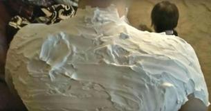 Mom's Shares A Quick Method For Healing Sunburns And Doctors Say It Really Works