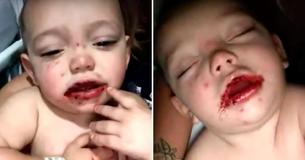Moeder waarschuwt andere ouders om ‘voorzichtig te zijn’ nadat ze blaren had ontdekt in de mond van haar zoontje van 1 jaar oud.