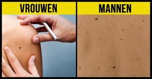 9 mythes over moedervlekken en de gezondheid van je huid die je moet negeren