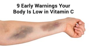 9 Warning Signs That Your Body Is Low In Vitamin C