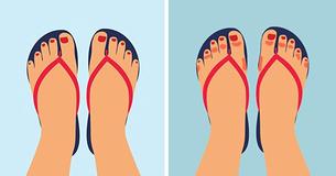 Wear Flip-Flops With Caution. Doctors Say There Are 8 Health Risks Of Wearing Flip-Flops