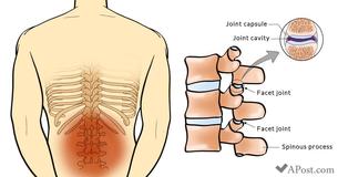 6 Stretches That Help Prevent And Relieve Lower Back Pain