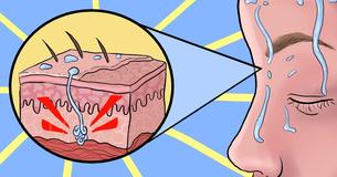 Esses sinais incomuns podem indicar que você está com deficiência de vitamina D