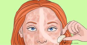10 produits de soins de peau qui éliminent les taches de pigments et agissent comme un charme