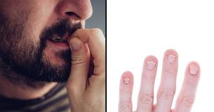 People Who Bite Their Nails Have THIS Trait In Common - And It's Not Anxiety