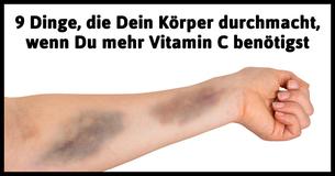 9 Warnsignale, dass Du einen Vitamin C-Mangel hast