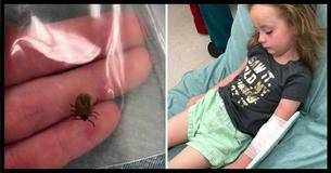Cette petite fille a été victime d'une paralysie qui aurait pu être facilement évitée - et maintenant sa mère tente d'avertir d'autres parents afin que leurs enfants ne subissent pas le même sort