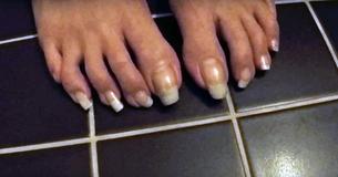 Deze zomer hebben veel mensen extra lange teen nagels; we weten niet zeker hoe we hier tegenoverstaan