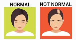 8 Things Your Hair Reveals About Your Health
