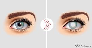 It's Better To Learn About These 10 Reasons For Vision Loss When You're Young