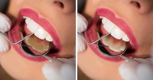 Most People Make These 8 Mistakes When Caring For Their Teeth
