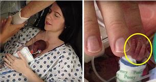 Moeder Kan Eindelijk Haar Dochter Van 340 Gram Vasthouden Na Maar Twee Weken