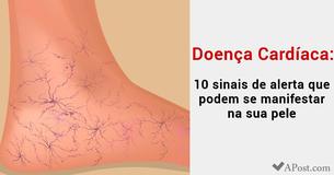 Doença Cardíaca: 10 sinais de alerta que podem se manifestar na sua pele