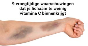 9 waarschuwingssignalen dat je lichaam te weinig vitamine C binnenkrijgt