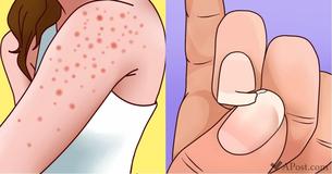 9 Symptoms Of Gluten Sensitivity You Should Never Ignore