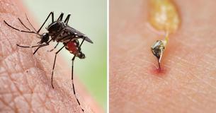 10 Bug Bites Everyone Should Be Able To Identify