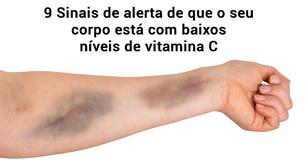 9 Sinais de alerta que mostram uma deficiência de vitamina C em seu corpo