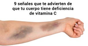 9  señales de advertencia de que tu cuerpo tiene poca cantidad de vitamina C