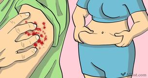 10 sintomas de níveis altos de açúcar no sangue que você não pode ignorar