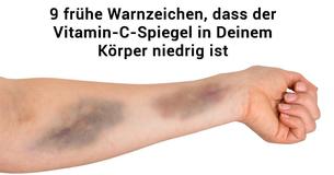 9 Warnzeichen, dass der Vitamin-C-Spiegel in Deinem Körper niedrig ist