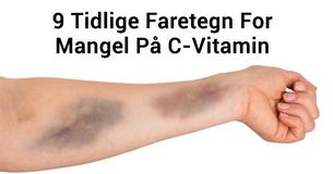 9 Faretegn På At Din Krop Mangler Vitamin C