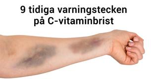 9 varningstecken på C-vitaminbrist 