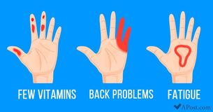 Your Hands Are Trying To Tell You These 7 Very Important Things About Your Body